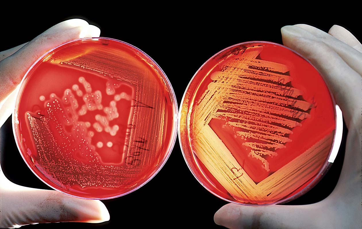 agar-g38dd4e982-pixabay-wikiimages_1920.jpg